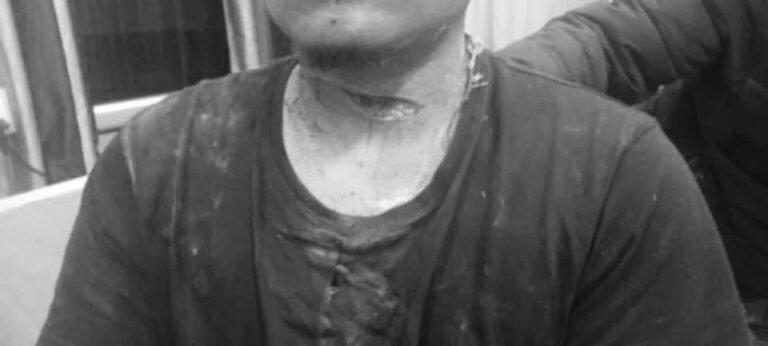 बेलडाँडीमा दुई युवाद्वारा घरमै खुकुरी प्रहार, एक जना गम्भीर घाइते