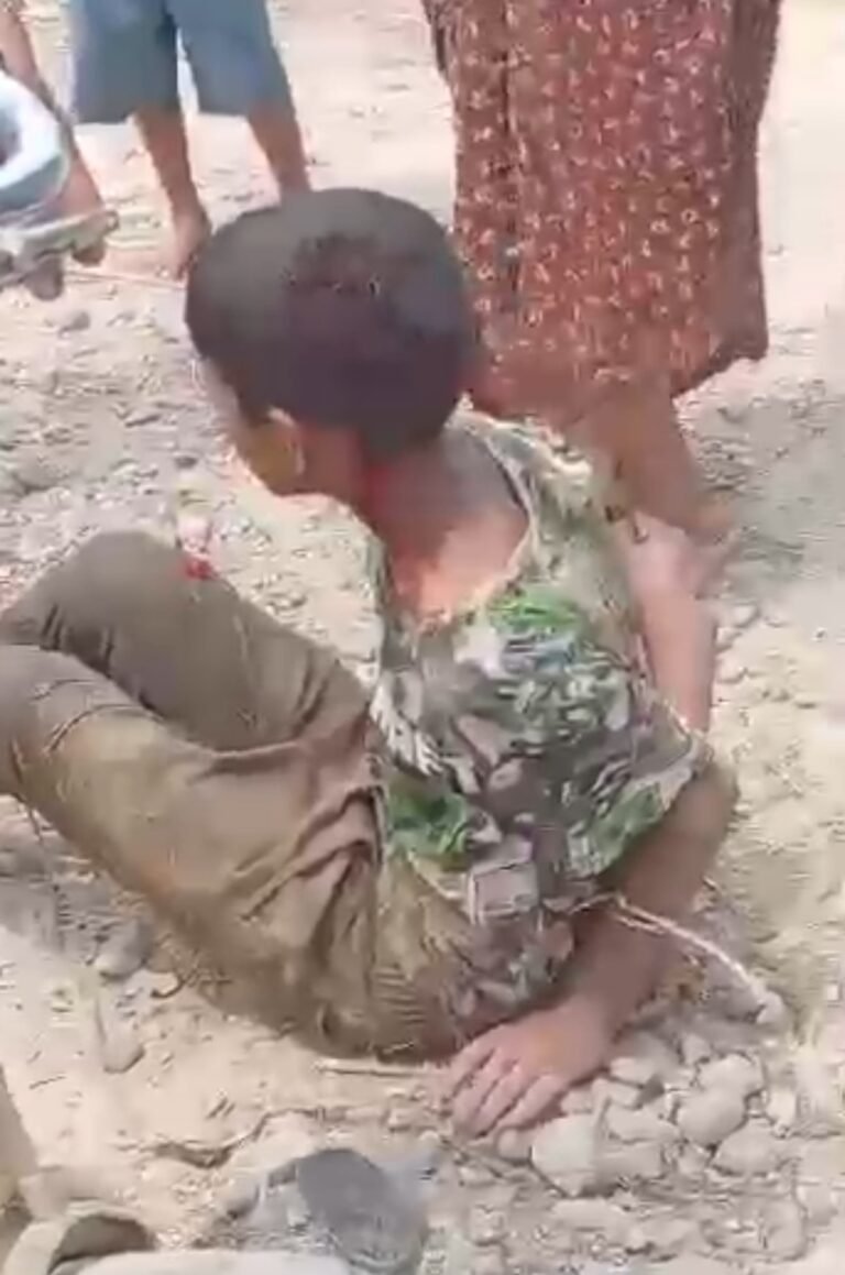 तरबुजा चोरीको आरोपमा ९ वर्षीय बालकको हातखुट्टा बाँधेर निर्घात कुटपिट